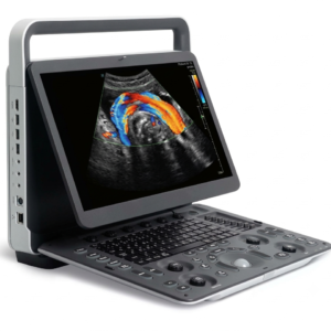 img_4940 Portable Ultrasound machine E1 Exp