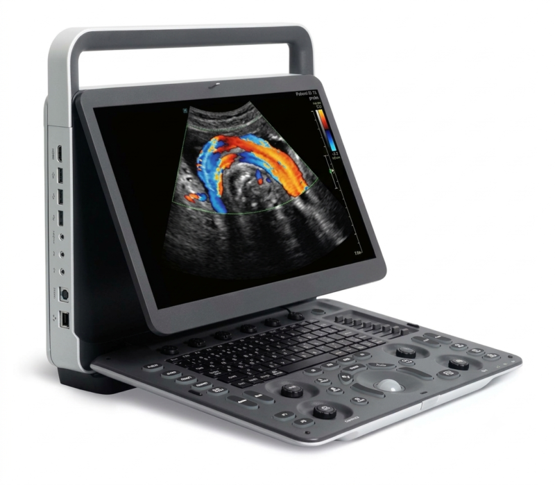 img_4940 Portable Ultrasound machine E1 Exp