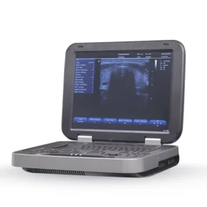 Yonker Cheap Portable Color Doppler Ultrasound Machine Yonker Cheap Portable Color Doppler Ultrasound Machine PU-L151A