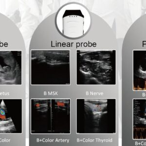 5116d45f-d36c-4220-a8af-7484122f48a3 Konted Dual head pocket ultrasound