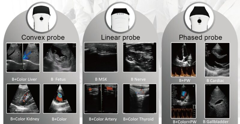 5116d45f-d36c-4220-a8af-7484122f48a3 Konted Dual head pocket ultrasound