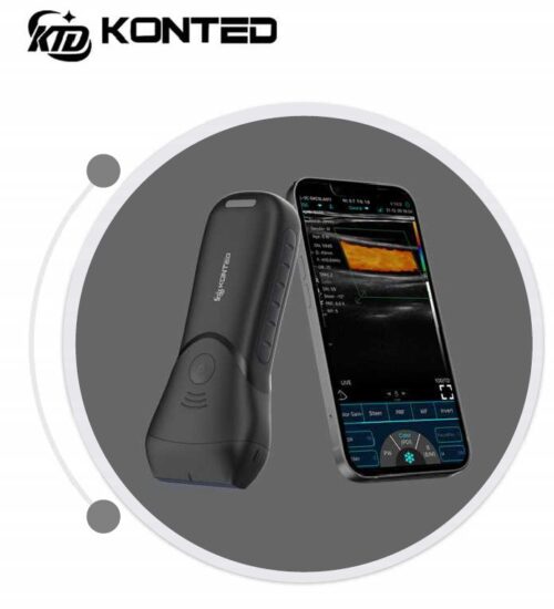 c85a6dc5-c710-4dd4-a78e-04ebc4a85202 C10 MX pro pocket ultrasound